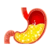 Gastrointestinal conditions