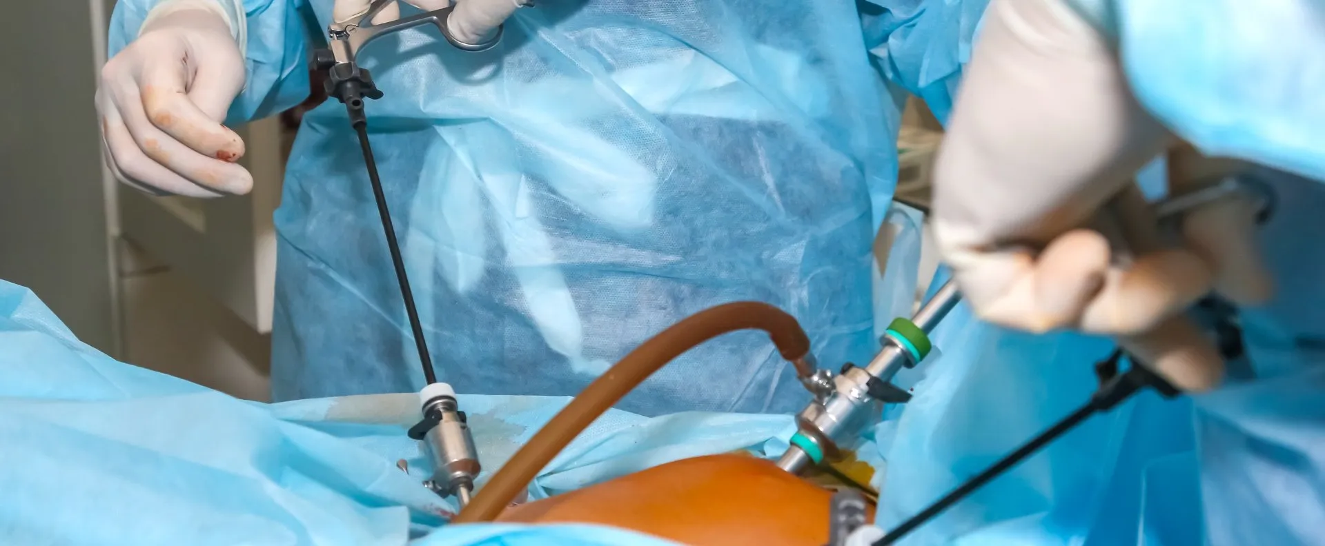 Laparoscopic